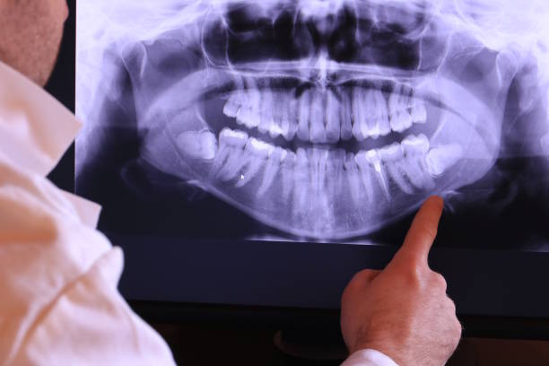 Best Tooth Pain Emergency Relief  in Middleport, NY